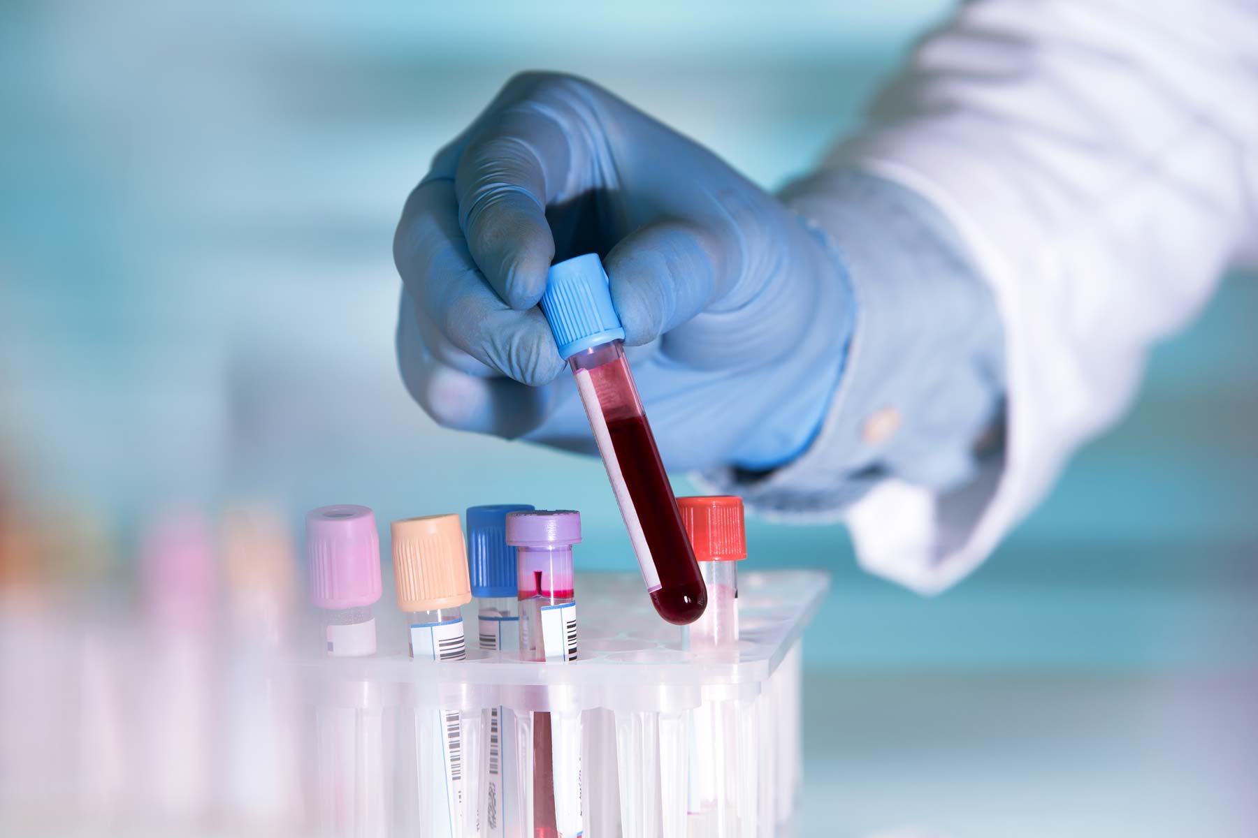 analisis de sangre