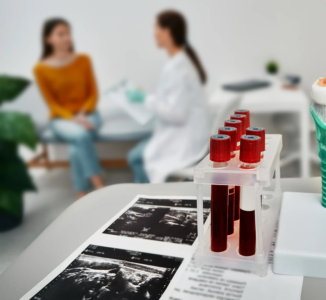 servicios de hematología