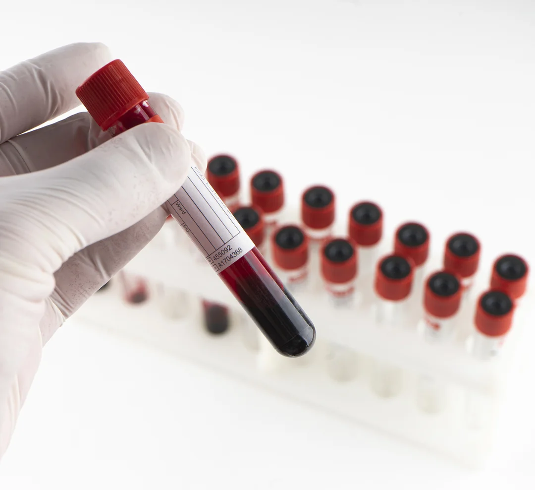 muestras de sangre